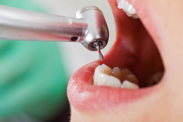 Best Broken Tooth Emergency  in Springtown, TX
